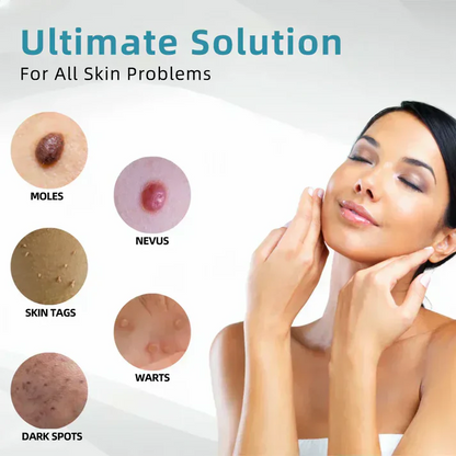 Xalnora™ All-in-One CO₂ Laser Eraser Pen | Removes Moles, Warts, Skin Flaws & Pigmentation